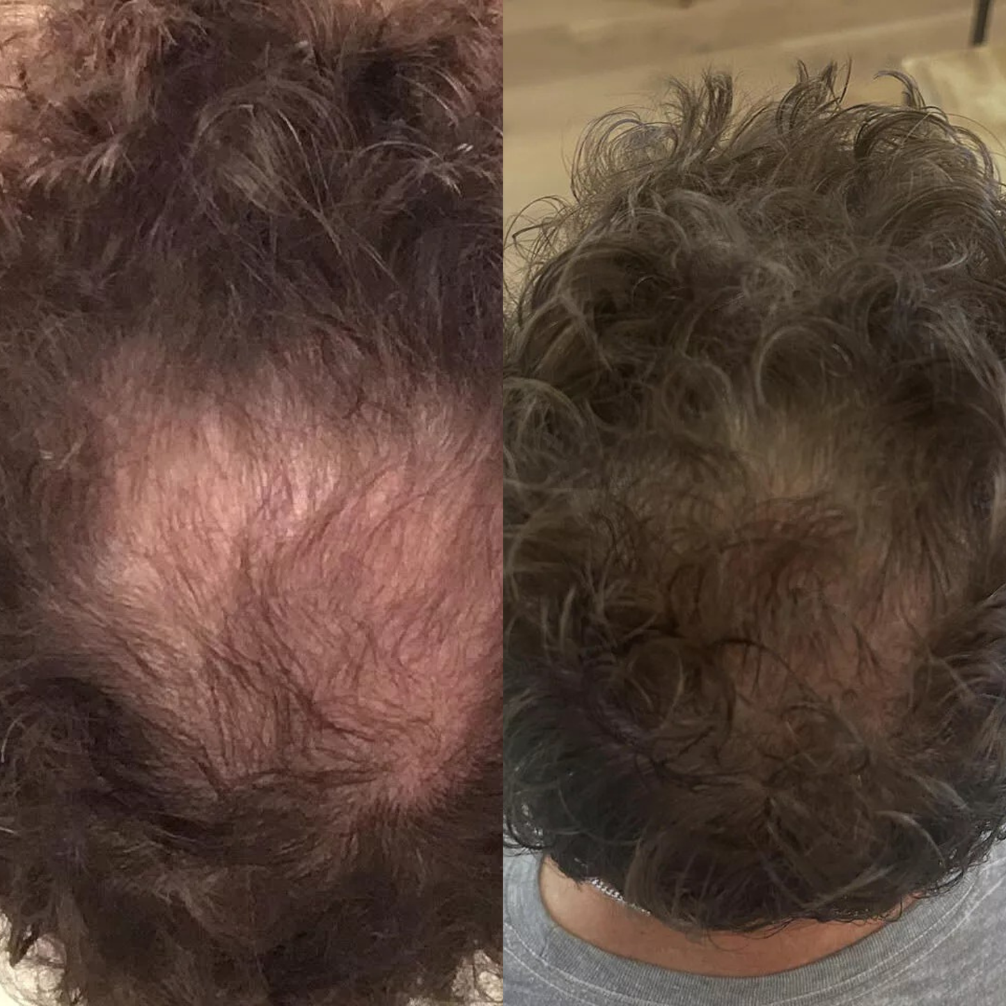 Reclaim – Sérum Repousse