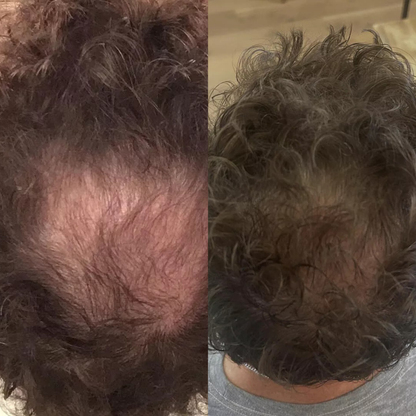 Reclaim – Sérum Repousse