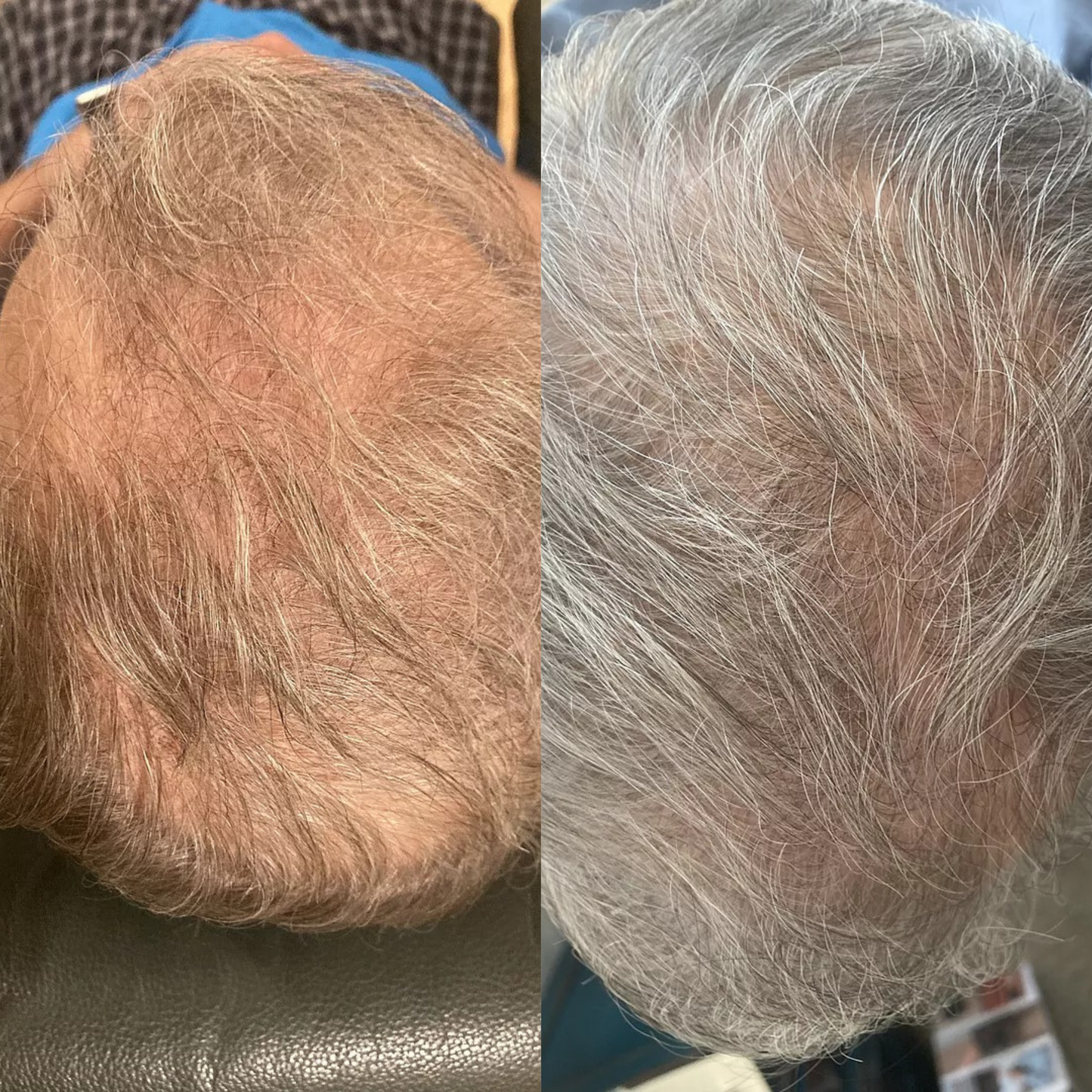 Reclaim – Sérum Repousse