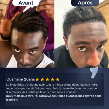 Reclaim – Sérum Repousse